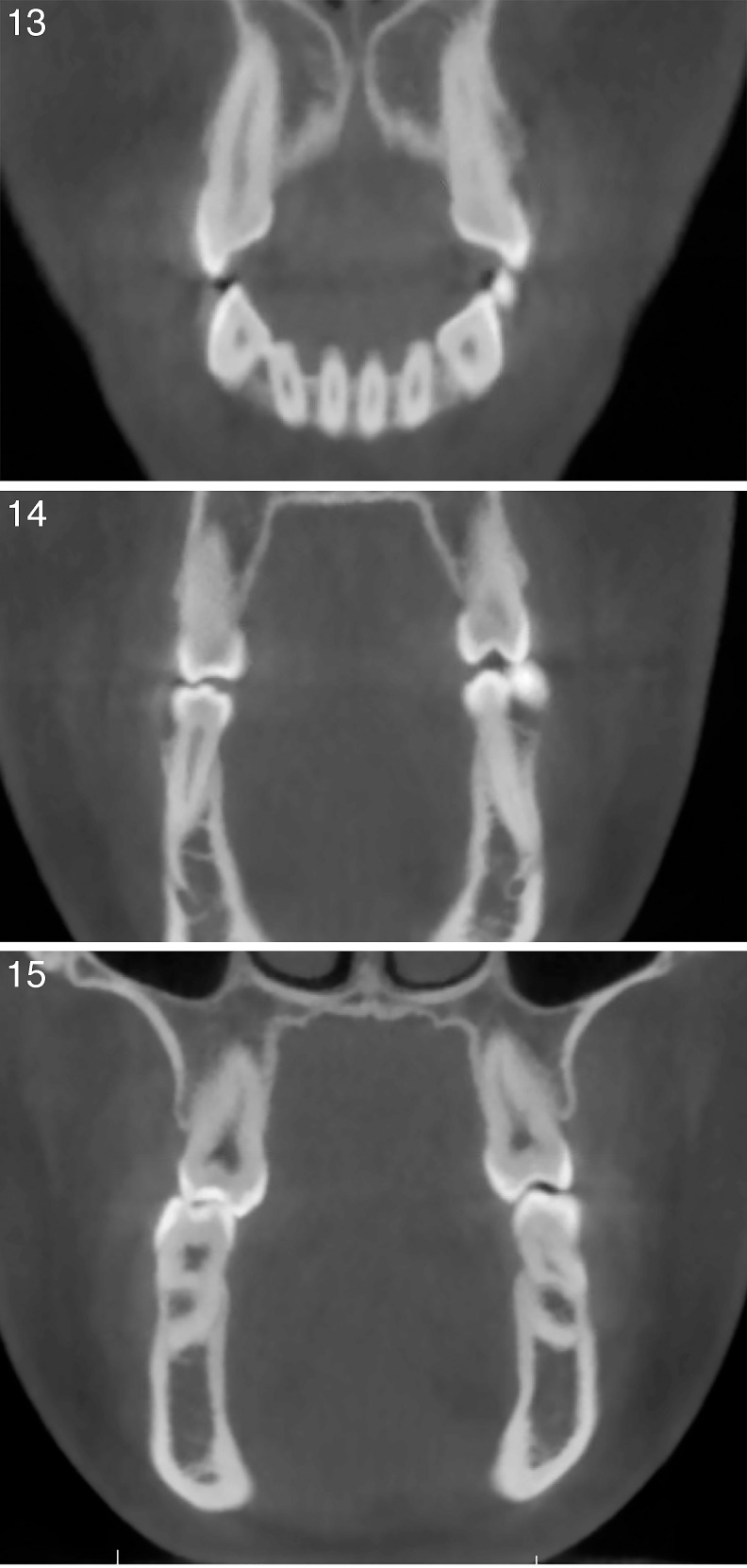 Figures 13–15.