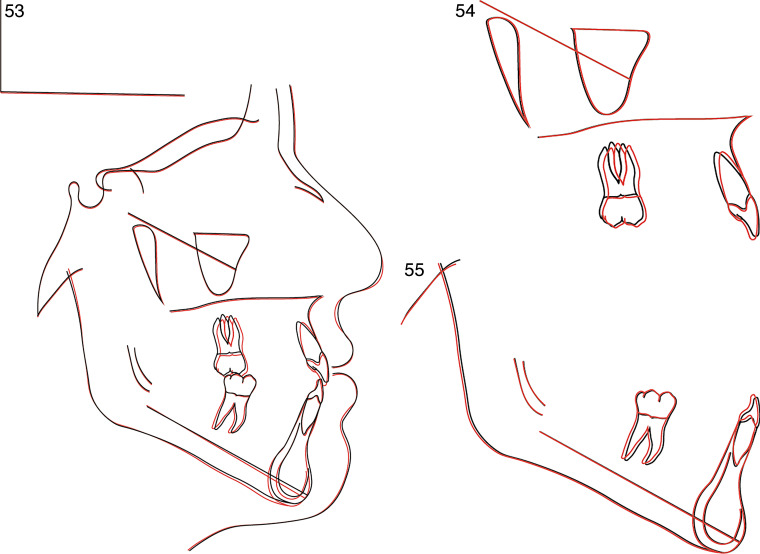 Figures 53–55.