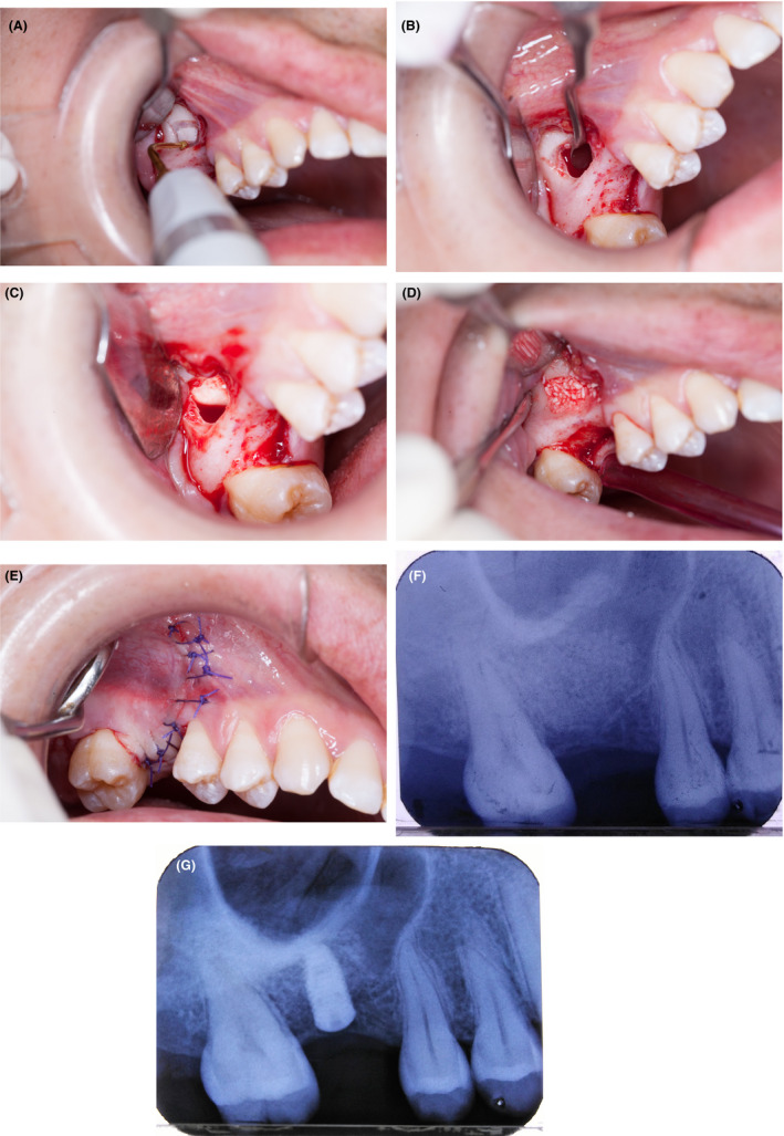 FIGURE 3