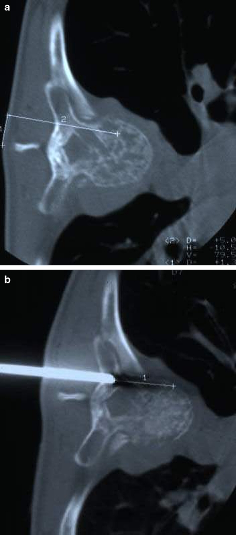 Fig. 1