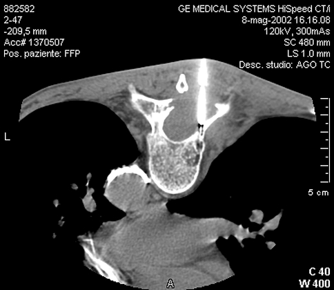 Fig. 3