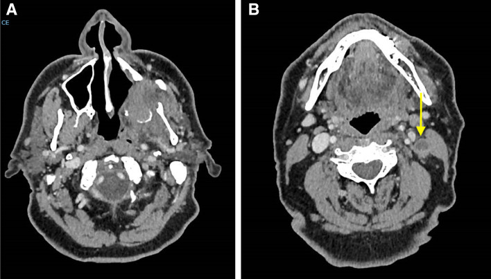 Fig. 3