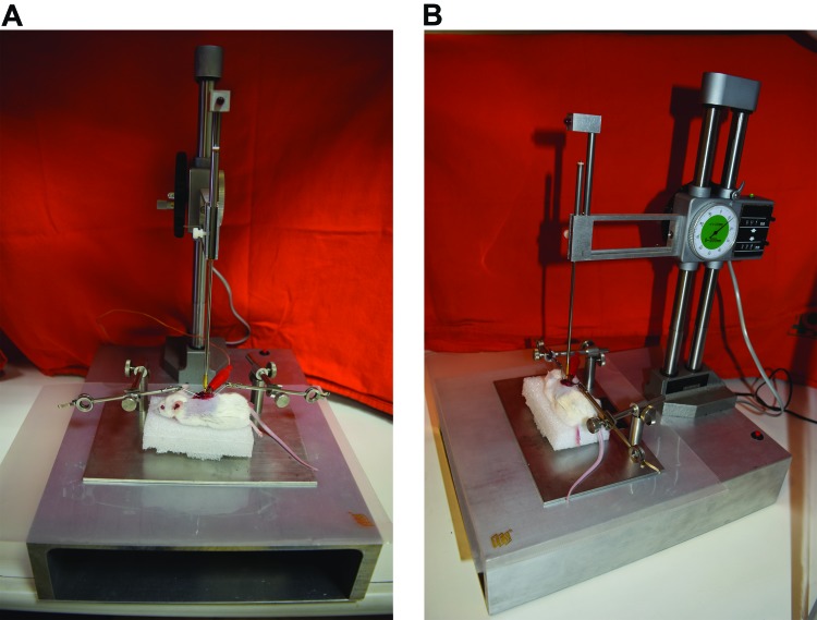 Figure 1A and 1B