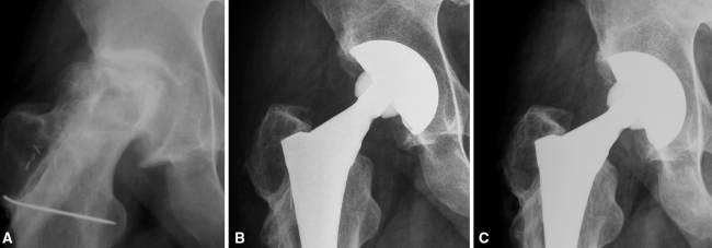 Fig. 4A–C