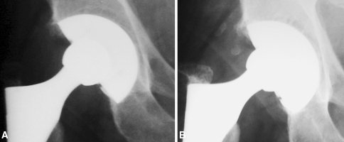 Fig. 5A–B