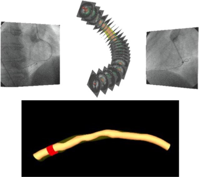 Fig. 1