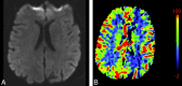 Fig 14.