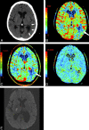 Fig 10.