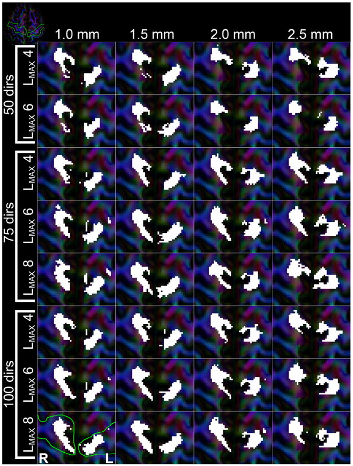 Fig. 15