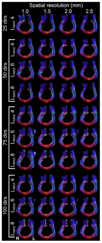 Fig. 14