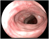Figure 11.