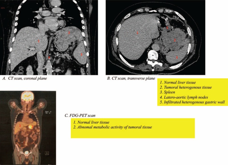 FIGURE 1