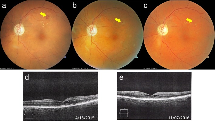 Fig. 3