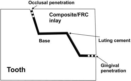 Fig. (1)