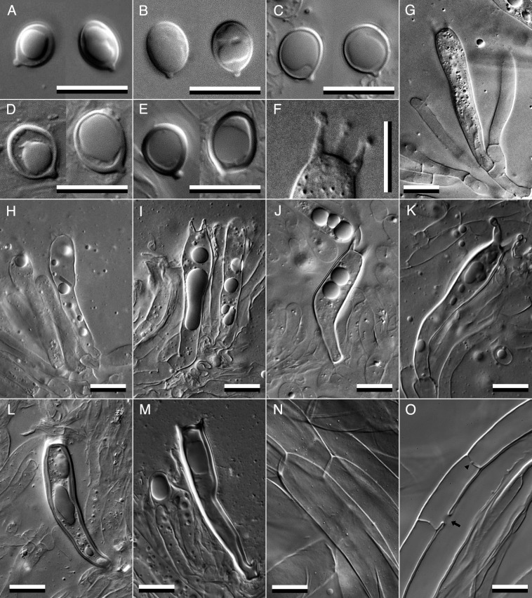 Fig. 9 - Microscopic features of Tricholoma
matsutake. A-E: basidiospores of AY-2200915-001 (Ukraine;
A), epitype AY-2041007-002 (Japan; B), its thick-walled sclerospore
type A of AY-2051104-002 (Japan; C), type B of AY-1981000-001
(China; D), and type C of AY-2070925-001 (Finland; E). F: sterigmata
of the epitype AY-2041007-002, in which three of four sterigmata on
a basidium can be seen in the same depth of field. G-M: Basidia of
the epitype AY-2041007-002 (G), its thick-walled sclerobasidium type
A of AY-2051104-002 (H) and AY-2070925-001 (I), type B of
AY-2051104-002 (J) and AY-2070925-001 (K), and type C of
AY-2051104-002 (L) and AY-2070925-001 (M). Superpellis (N) and
subpellis (O) hyphae in the pileipellis layers of the epitype
AY-2041007-002. The arrow indicates anastomosis between parallel
hyphae, and the arrowhead indicates a barrel-shaped swelling on the
dolipore septum.Bars: 10 μm.