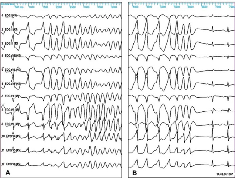 Figure 2: