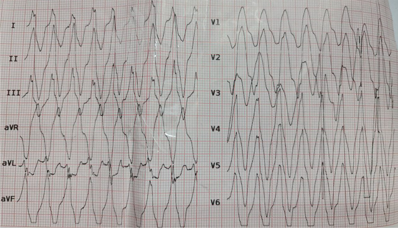 Fig. 2