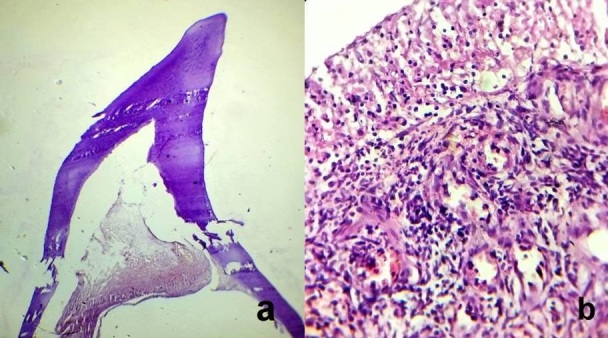 [Table/Fig-3a,b]: