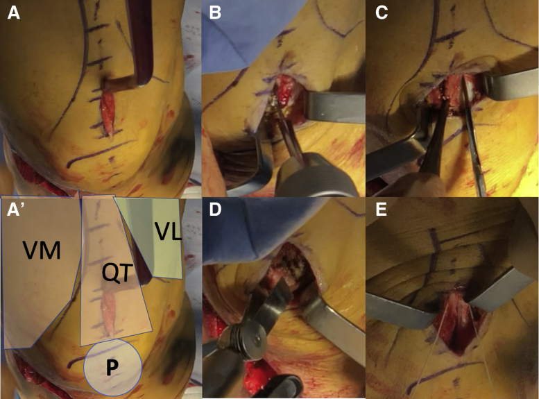 Fig 3