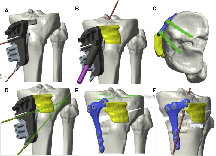 Fig 1