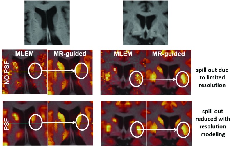 Fig. 14.