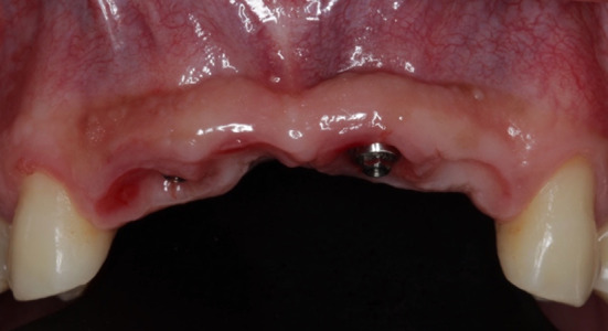 Fig. 8