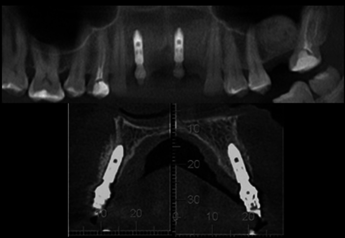 Fig. 9