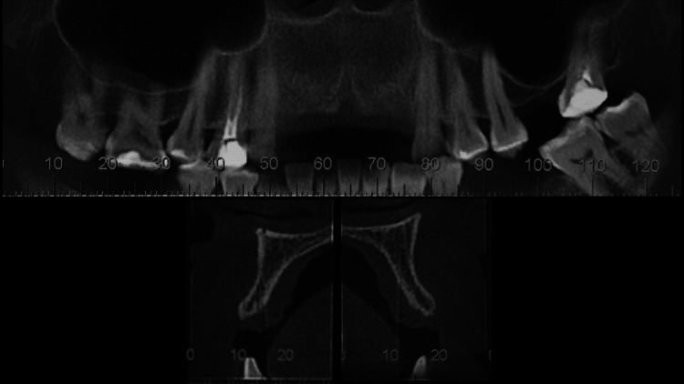 Fig. 1