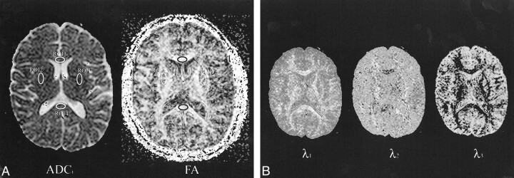 fig 1.