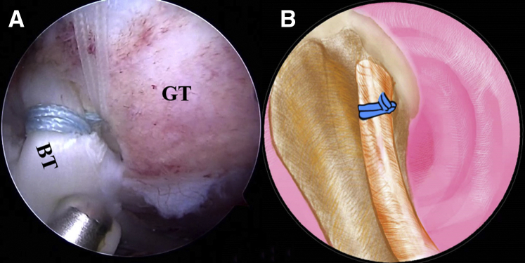 Fig 10