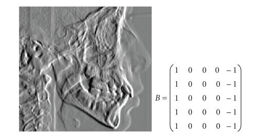 Figure 15