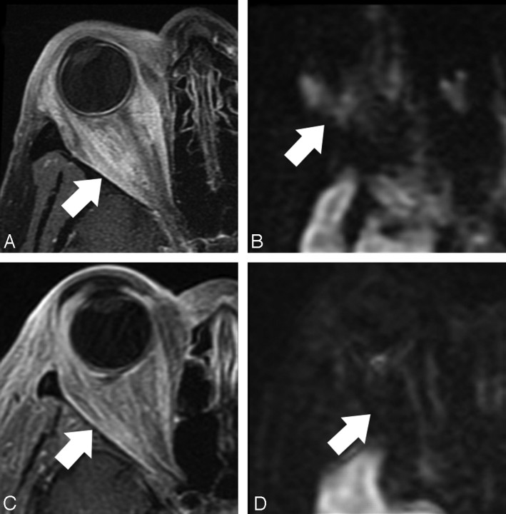 Fig 4.