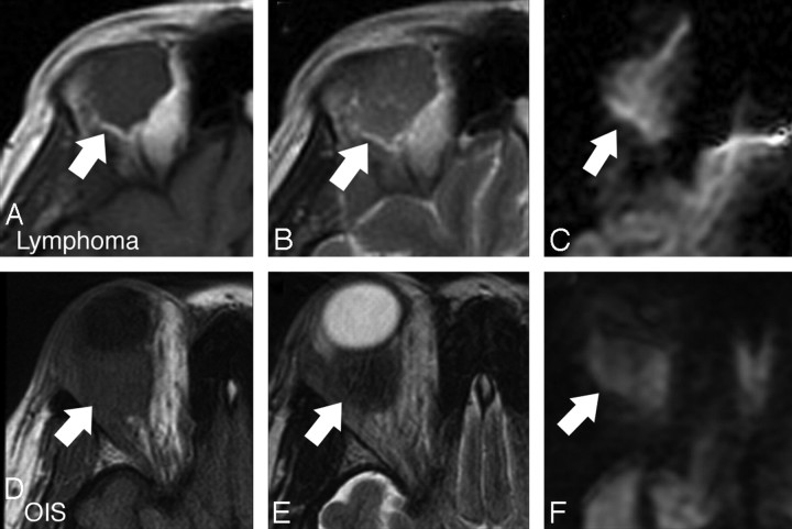 Fig 2.