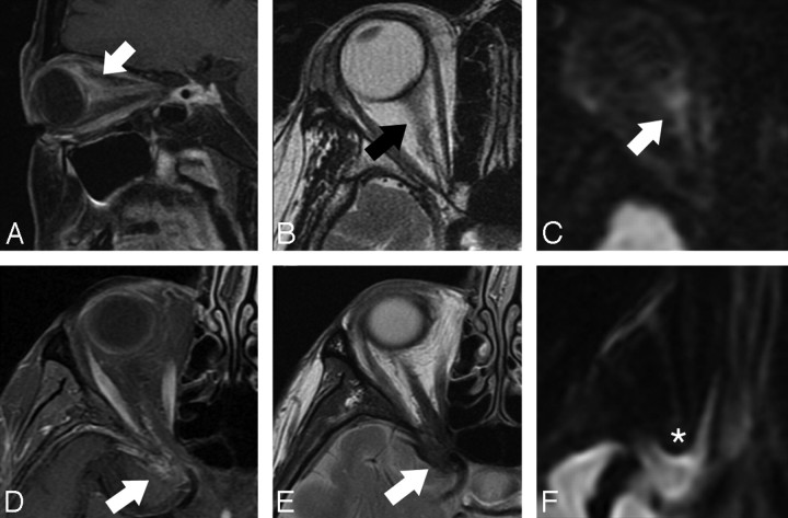 Fig 3.