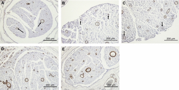 Fig. 13