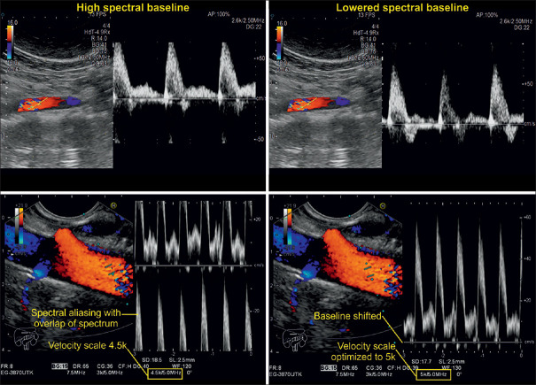 Figure 28