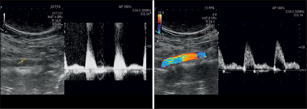 Figure 27