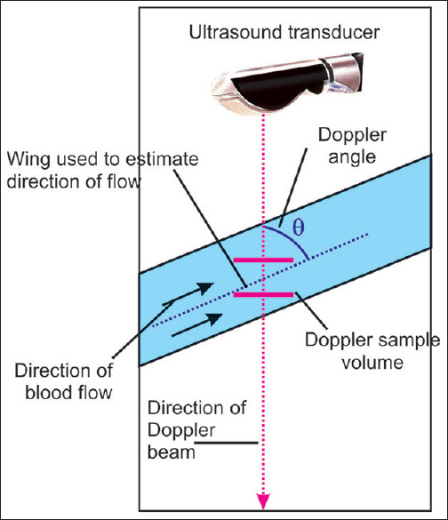 Figure 23