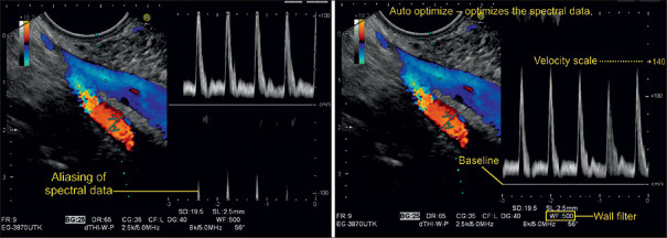 Figure 26