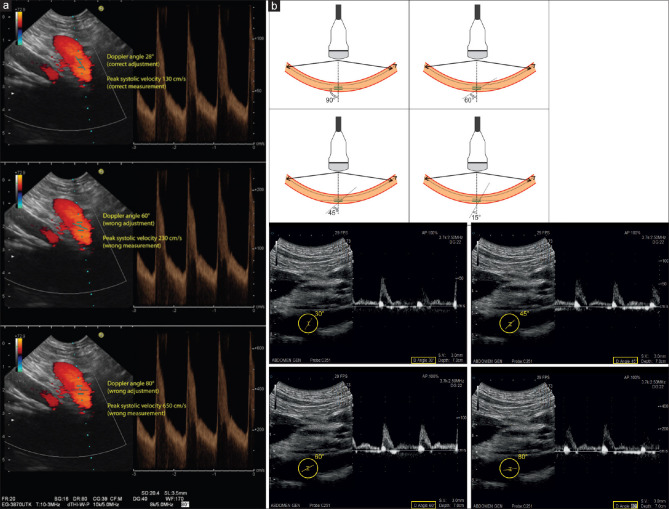 Figure 24