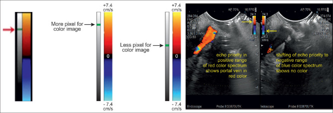 Figure 22