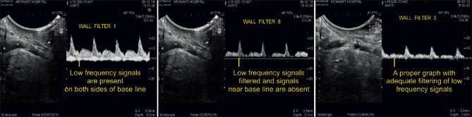 Figure 29