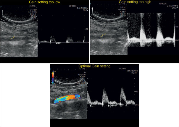 Figure 25