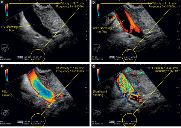 Figure 18