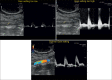 Figure 25