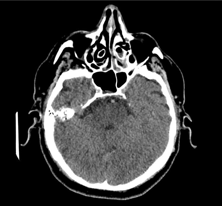 Fig. 1 –