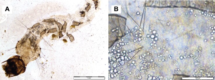 Microscopic images illustrating the morphological effects of Metarhizium anisopliae (Meta–G4) on Aedes mosquito larvae. Figure (A) shows extensive degradation of intestinal cells in the gut lumen, with visible tissue fragmentation and structural disintegration at a scale of 1 mm. Figure (B) depicts a higher magnification view (100 µm scale) showing the accumulation and colonization of fungal conidia spores within the larval gut, surrounded by vacuolated regions and hair-like structures. These images highlight the pathogenic impact of fungal infection on larval tissue integrity.