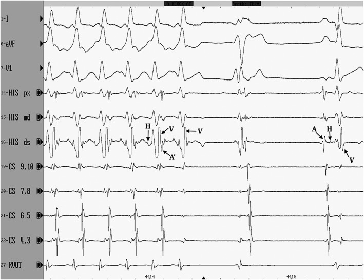 Figure 5