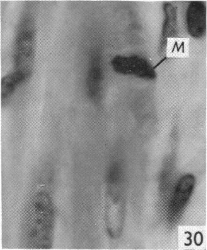 Fig. 30