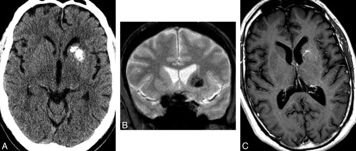 Fig 2.